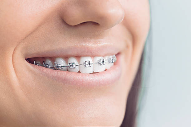 Best Wisdom Tooth Removal  in Richmond, IN